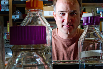 Parkinsonian worms