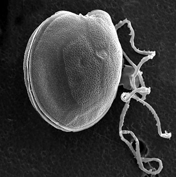 Gambierdiscus toxicus.