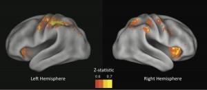 Brain Scans Reveal Activity Associated with Risky Choices
