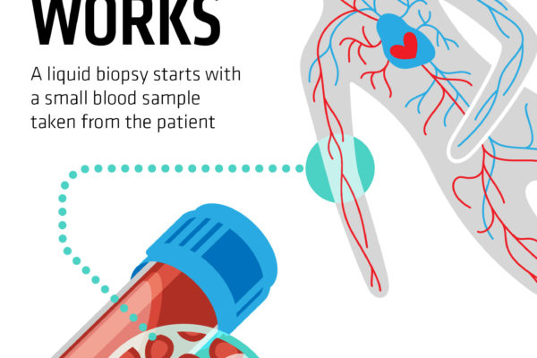 liquid_biopsy_infographic
