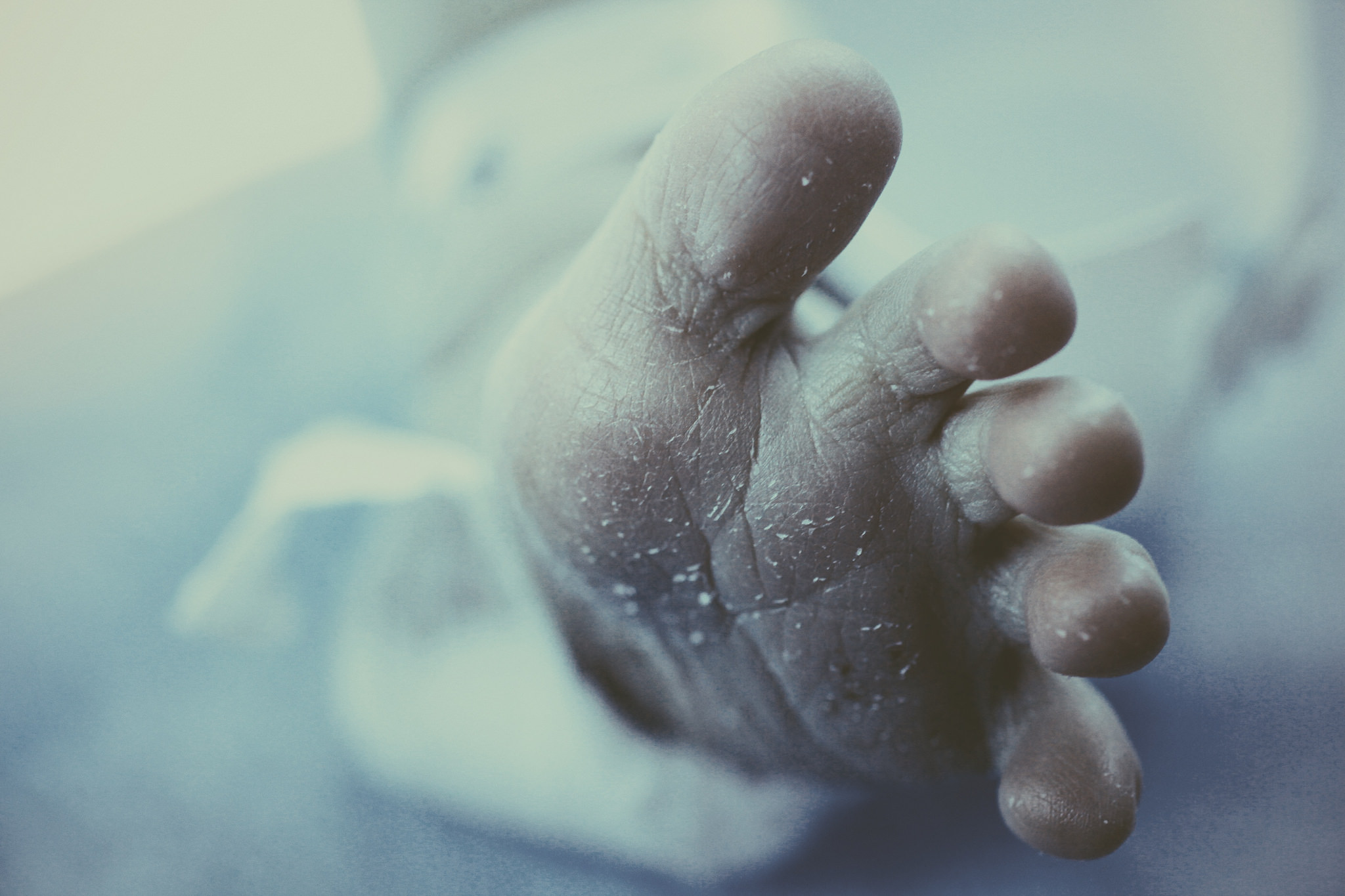 jaundicebaby_flickr_medhead_28904955505