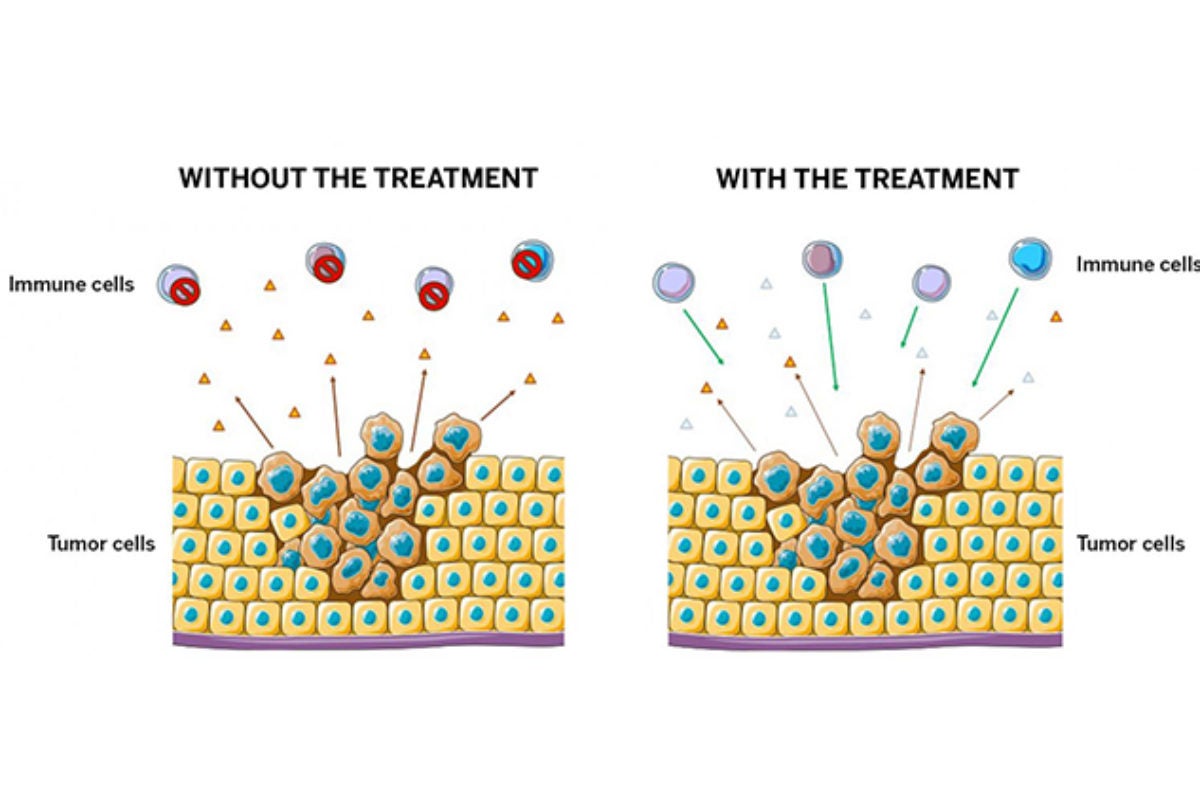 New Cancer Treatment Uses Enzymes to Boost Immune System and Fight Back