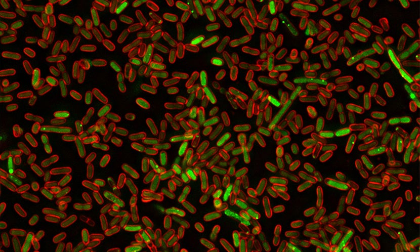 E coli with damaged DNA