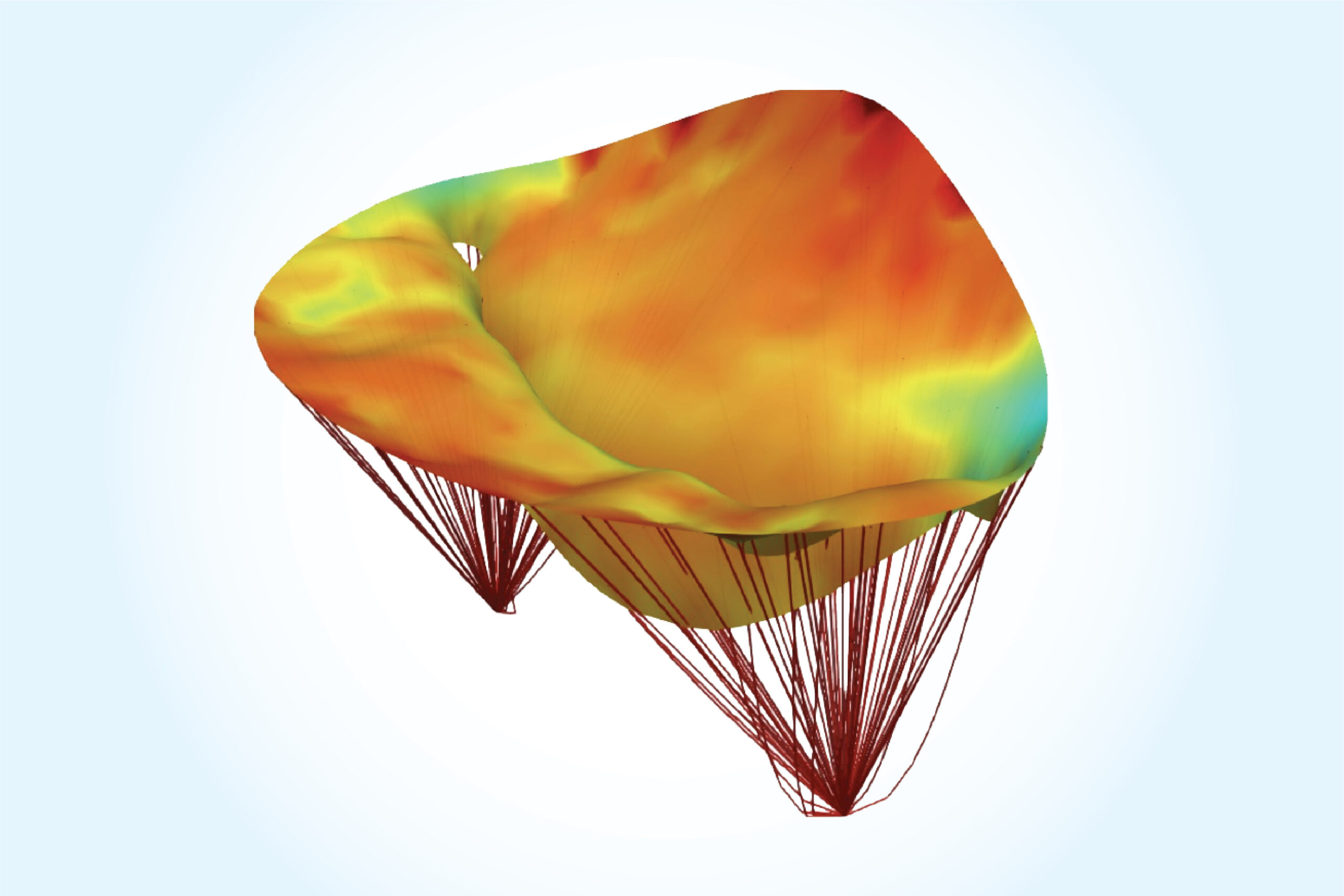 A computational model of the heartâs mitral valve pre-surgery.