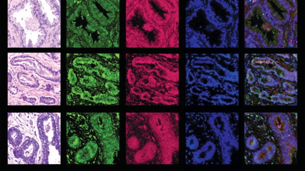 Stained cross sections of tissues.