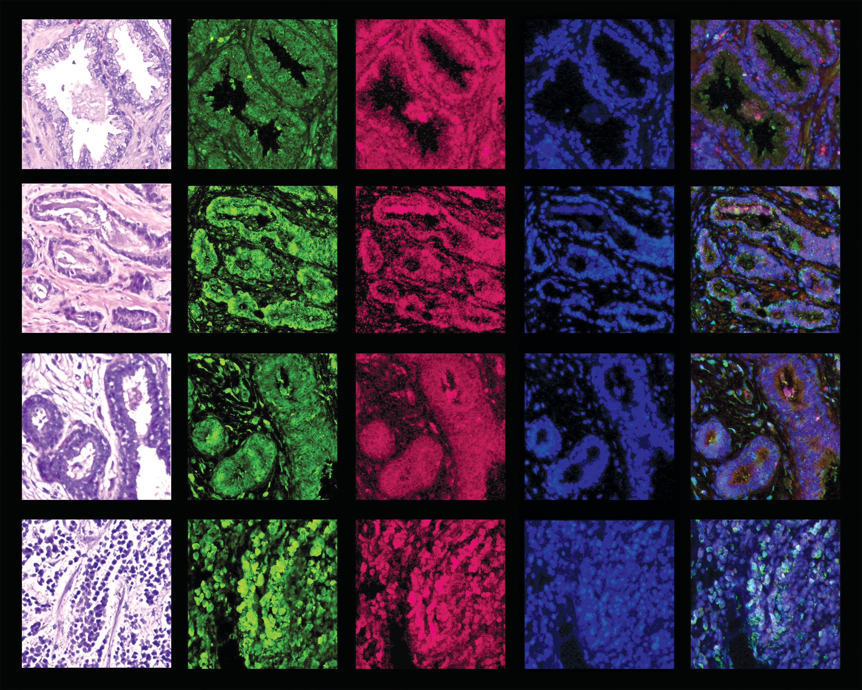 Stained cross sections of tissues. Stained cross sections of tissues.