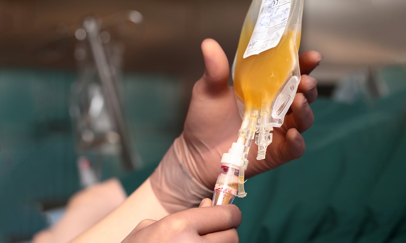 COVID-19 Convalescent Plasma Therapy is Safe, With 76% of Patients Improving - UT News