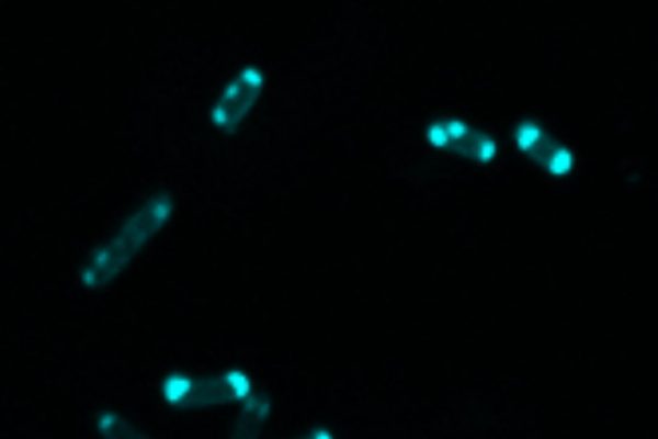 Image shows glowing blue-green dots on a black background. The glowing dots represent a florescent chemical probe that glows in the presence of an enzyme called NDM.