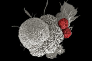 Microscope image of cancer cell in white being attacked by T cells in red