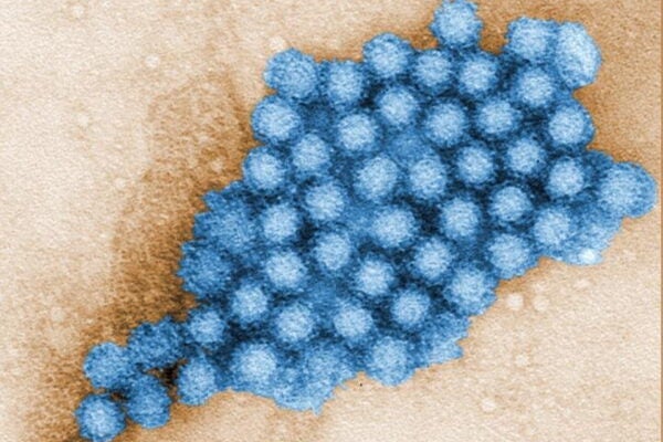 Photo rendering of norovirus