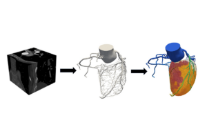 Cardiac digital twin model.