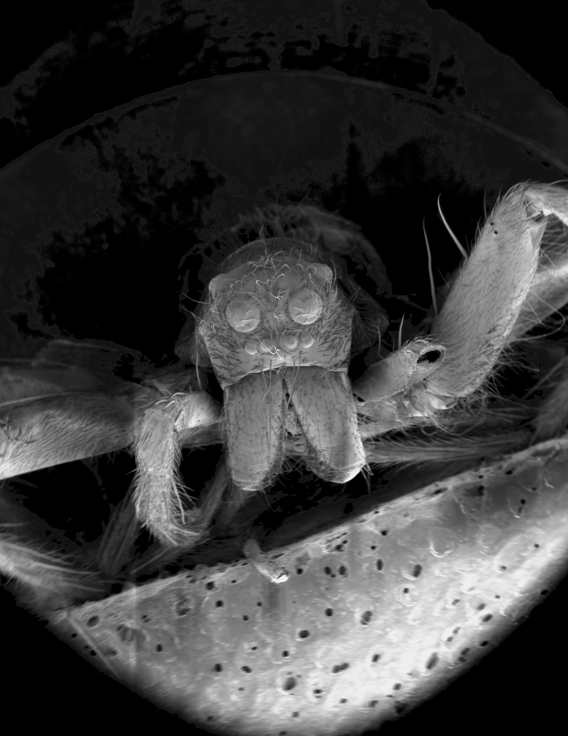 A close up, black and white image of a wolf spider through a microscope.